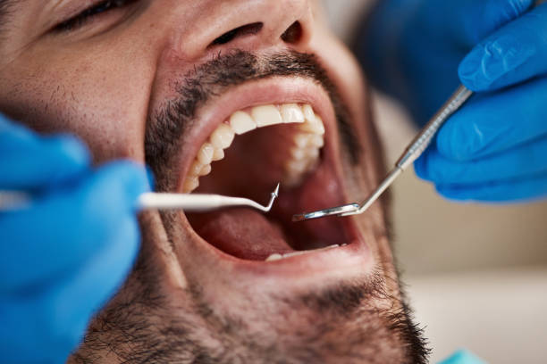 Best Emergency Dentist for Lost Fillings or Crowns in Pirtleville, AZ